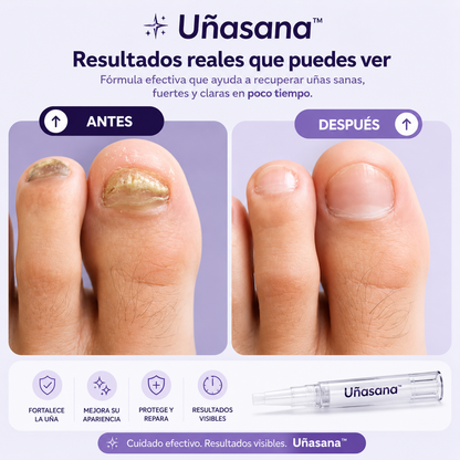Uñasana™ | Lápiz Antihongos